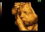 3d_sonogram